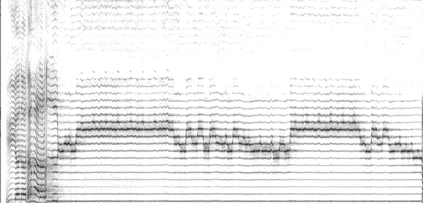 A frequency-domain representation of a soundwave